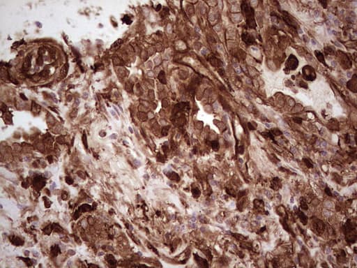 LGALS9 / Galectin 9 Antibody (clone OTI1D12)