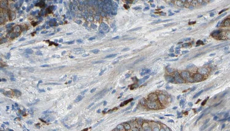 Polyclonal Rabbit anti-Human CAPZA2 / CAPZ Alpha 2 Antibody (IHC, WB)