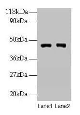 IHC-plus™ PGK1 / Phosphoglycerate Kinase Antibody