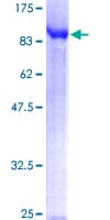 Human TDP1 Protein (Recombinant GST)