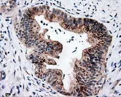 Monoclonal Mouse anti-Human BAP / SIL1 Antibody (clone OTI1G7, IHC, IF, WB)