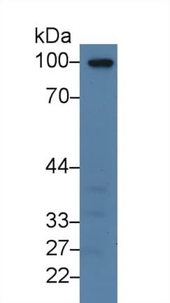 THBD / CD141 / Thrombomodulin Antibody (aa31-169)