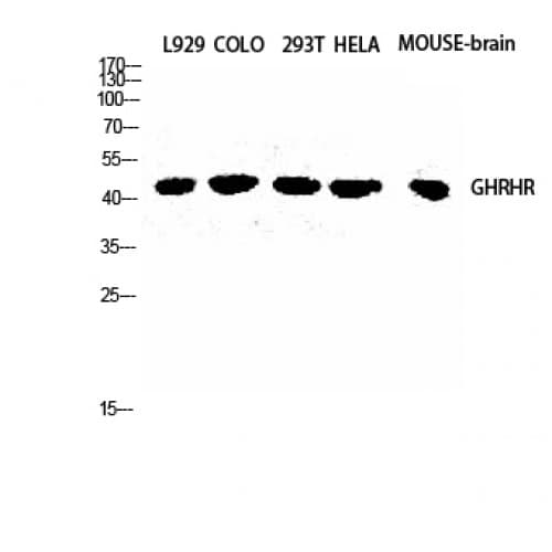 GHRHR Antibody (320-400 aa, C-terminal)