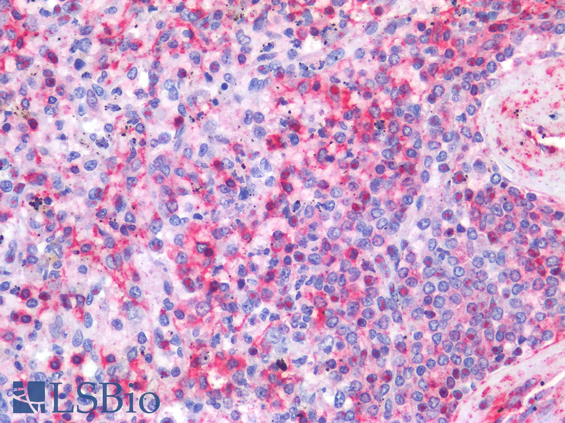 PathPlus™ Monoclonal Mouse anti-Human HCLS1 Antibody (clone 2A8, IHC, WB)