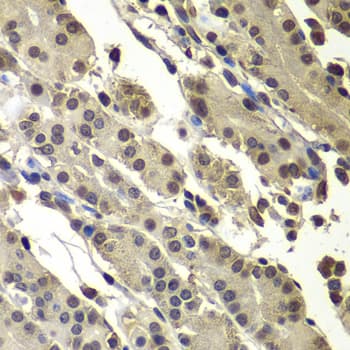 Polyclonal Rabbit anti-Human SUB1 Antibody (IHC, IF, WB)