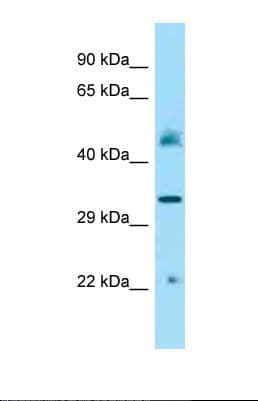 IDUA / MPS1 Antibody (aa121-170)