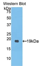 PCOLCE Antibody (aa315-437)