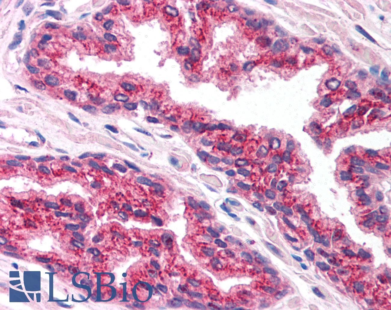 Polyclonal Rabbit anti-Human FOXA1 Antibody (aa395-444, IHC, WB)
