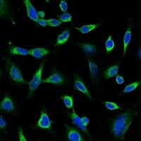 IHC-plus™ Monoclonal Mouse anti-Human PRDX1 / Peroxiredoxin 1 Antibody (IHC, IF, WB)