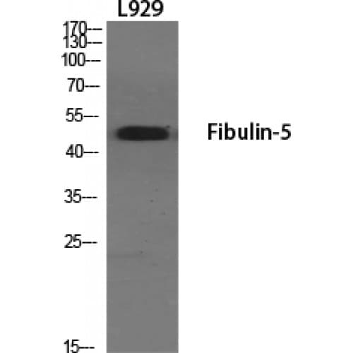 FBLN5 / Fibulin 5 Antibody (140-220 aa, Internal)