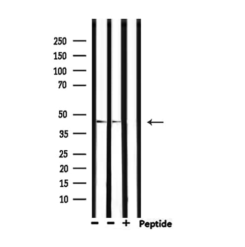 Polyclonal Rabbit anti-Human WNT1 Antibody (IHC, IF, WB)