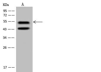 PRPF19 / PRP19 Antibody
