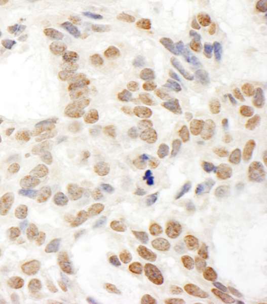 POP1 Antibody (aa75-125)