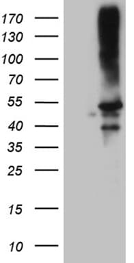 CLP1 Antibody (aa1-226, clone OTI2D2)