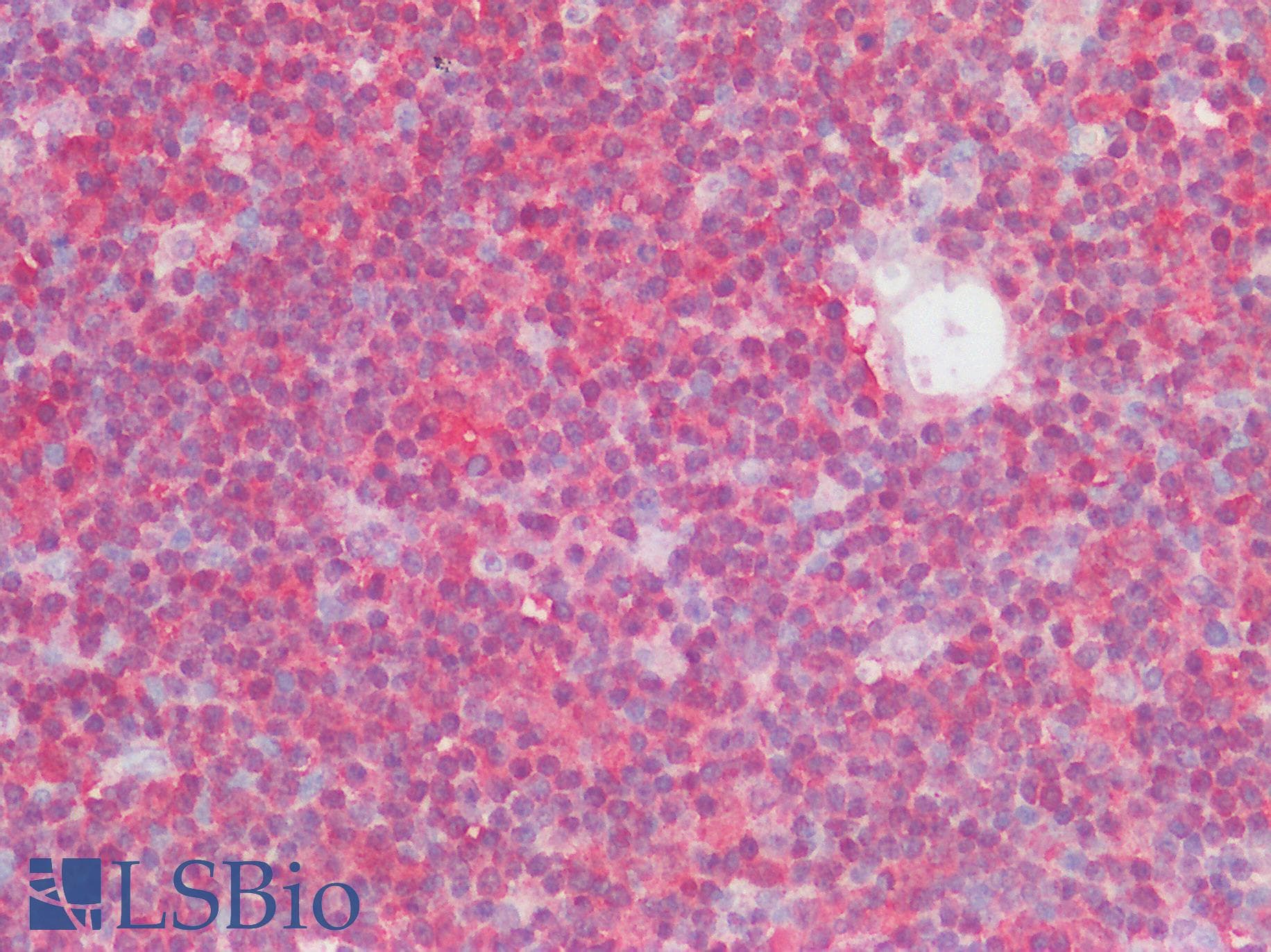 Polyclonal Rabbit anti-Human LILRB2 / ILT4 Antibody (IHC, WB)