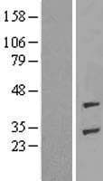 ADPRHL1 Protein (Over-Expression Lysate Myc-DDK (Flag))