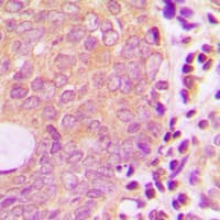 Polyclonal Rabbit anti-Human WC1 / ATP7B Antibody (N-Terminus, IHC, IF, WB)