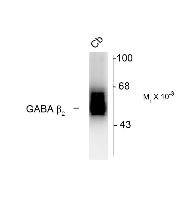 GABRB2 Antibody (Cytoplasmic Domain)