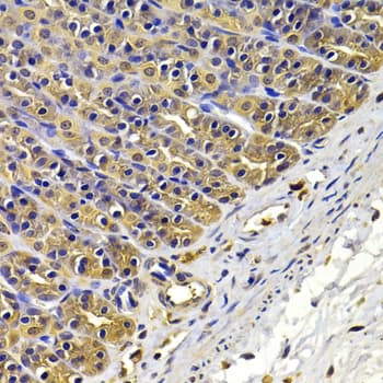 IHC-plus™ Polyclonal Rabbit anti-Human FSCN1 / Fascin Antibody (IHC, WB)