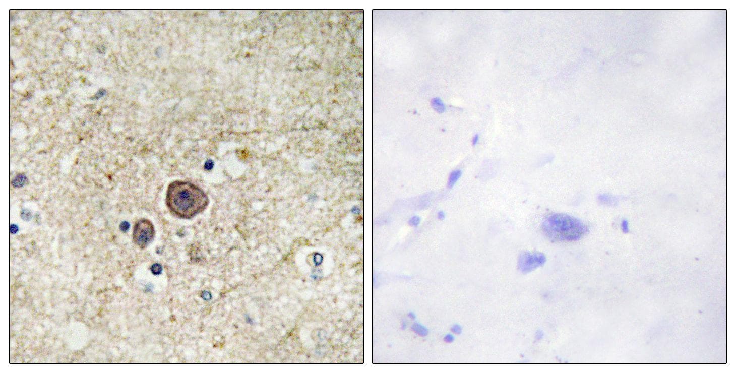CTNNA1 / Catenin Alpha-1 Antibody (phospho-Ser641)