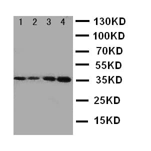 Polyclonal Rabbit anti-Human PROC / Protein C Antibody (aa446-461, IHC, WB)