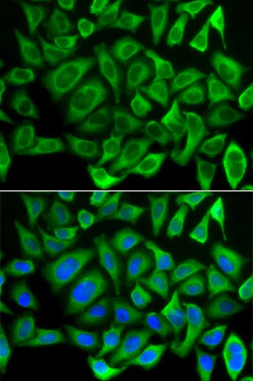 Polyclonal Rabbit anti-Human CYCS / Cytochrome c Antibody (IHC, IF, WB)