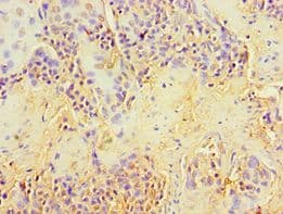 Polyclonal Rabbit anti-Human GRB4 / NCK2 Antibody (aa1-380, IHC, WB)