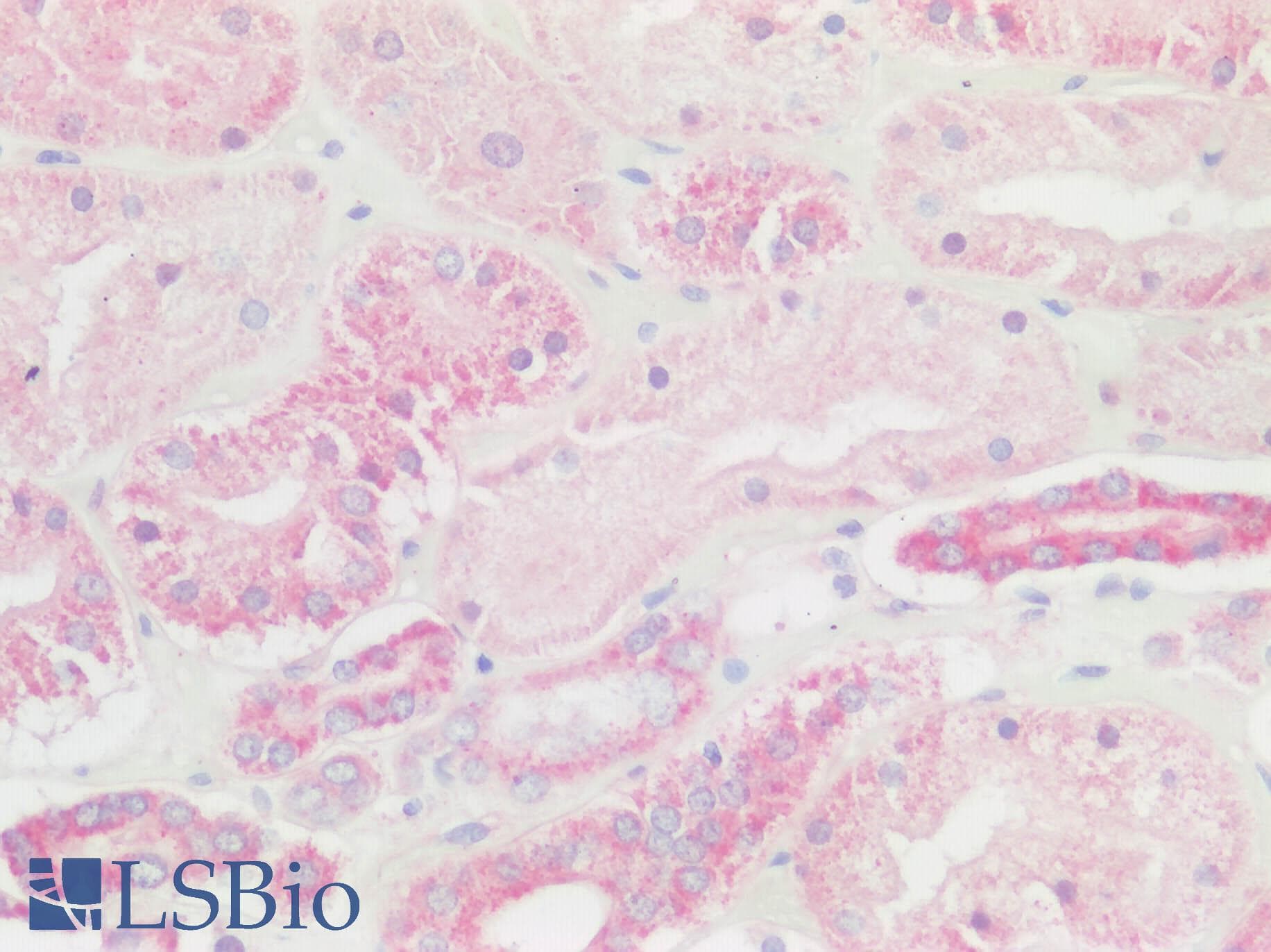 PathPlus™ Polyclonal Rabbit anti-Human BMP6 Antibody (IHC)