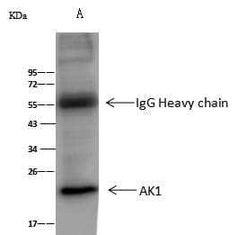 Polyclonal Rabbit anti-Rat AK1 / Adenylate Kinase 1 Antibody (Preservative Free, WB)