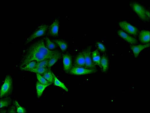 Polyclonal Rabbit anti-Human MYO7A / Myosin-VIIa Antibody (IHC, IF)