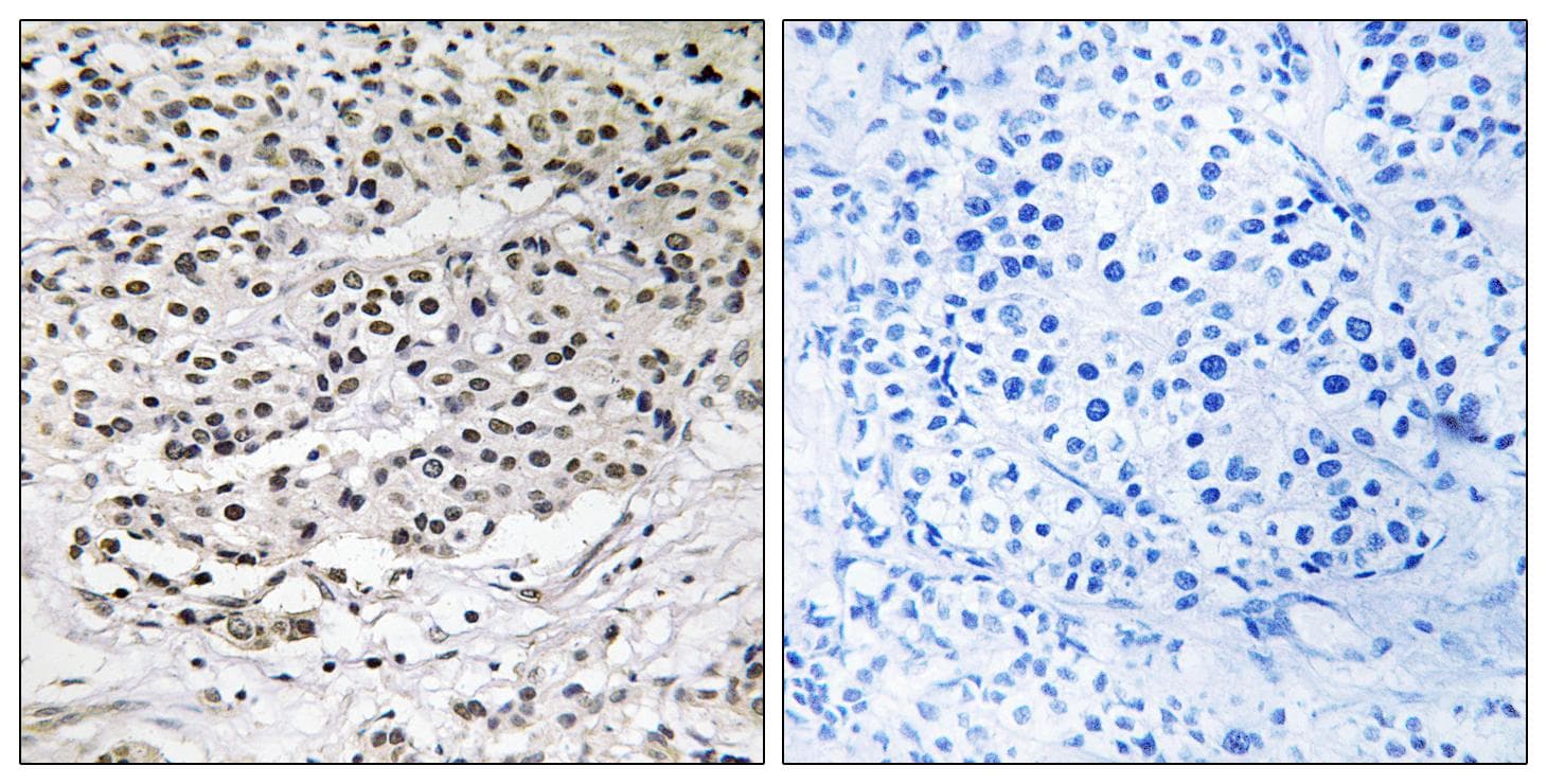Polyclonal Rabbit anti-Human CEP131 / AZI1 Antibody (IHC, WB)