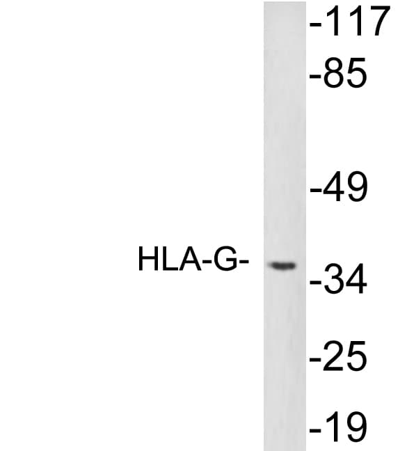 IHC-plus™ Polyclonal Rabbit anti-Human HLA-G Antibody (aa45-94, IHC, WB)