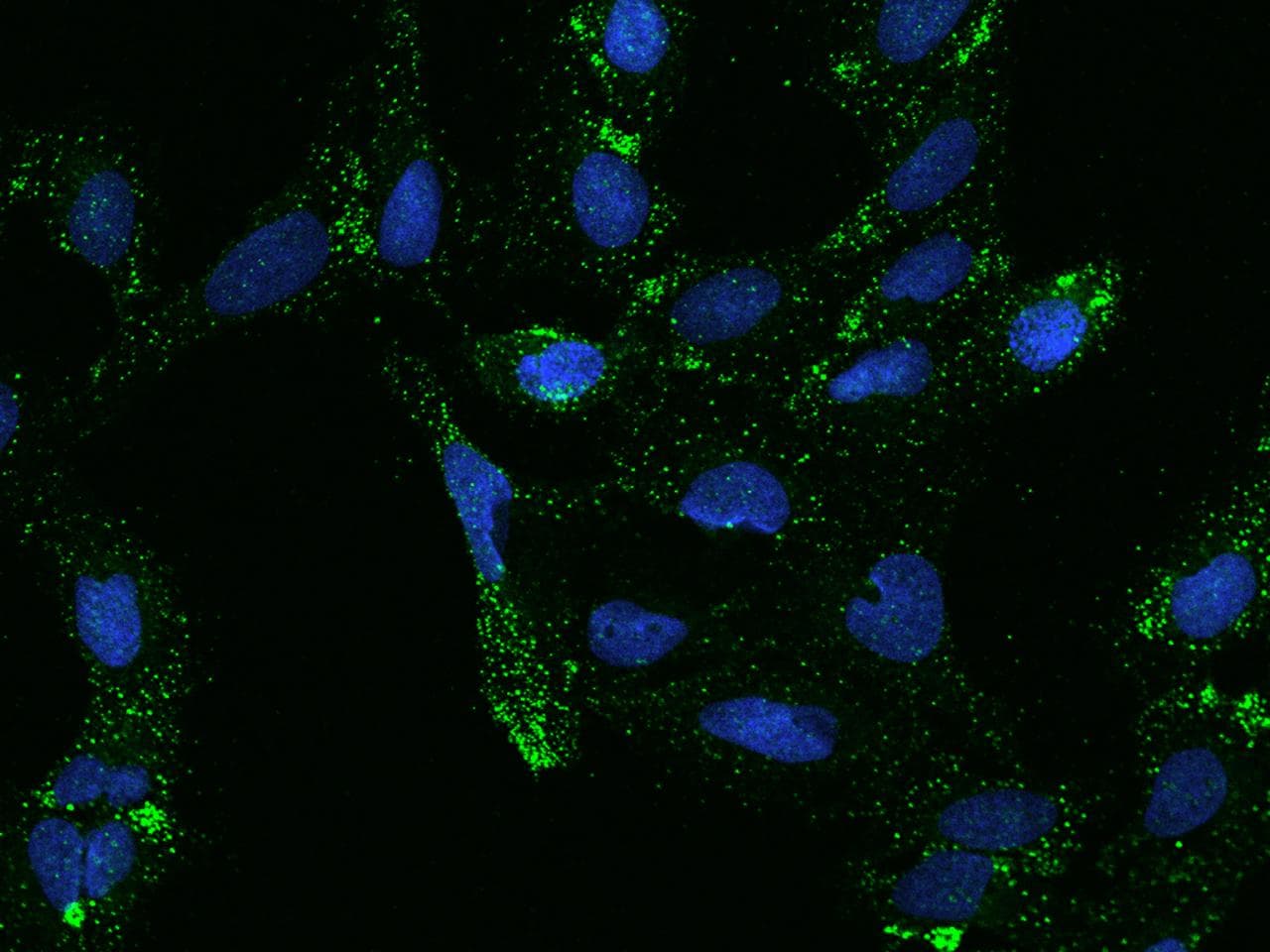 SLC26A11 Antibody