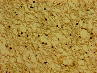 Polyclonal Rabbit anti-Human SYNPR / Synaptoporin Antibody (WB)