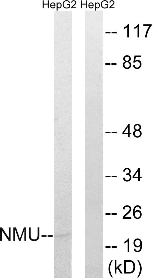 NMU / Neuromedin U Antibody (aa125-174)