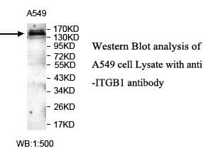 Polyclonal Rabbit anti-Human ITGB1 / Integrin Beta 1 / CD29 Antibody (aa94-356, IHC, WB)