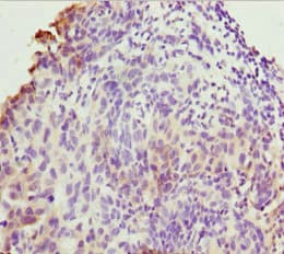 TMEM43 Antibody