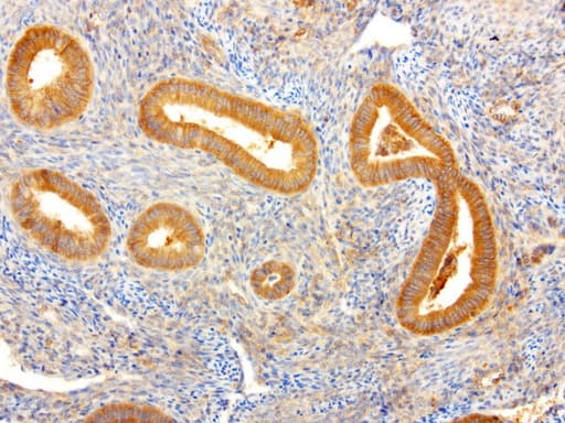 Monoclonal Mouse anti-Human NME1 / NM23 Antibody (clone UMAB94, Carrier-free, IHC, IF, WB)