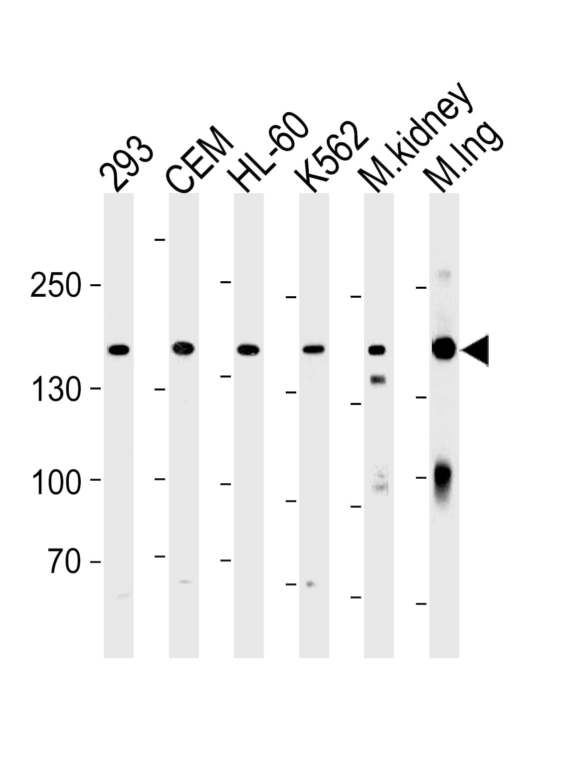 IHC-plus™ PKP4 / Plakophilin 4 Antibody (aa1040-1068)
