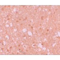 Polyclonal Rabbit anti-Human LIN41 / TRIM71 Antibody (IHC, IF, WB)