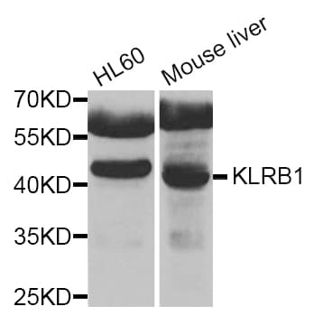 KLRB1 / CD161 Antibody
