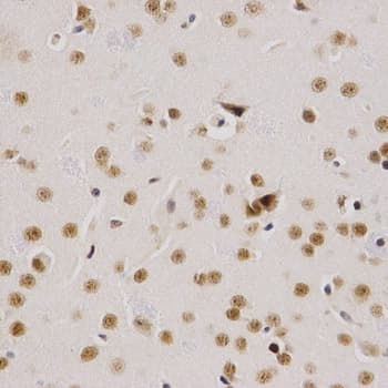 SMARCE1 / BAF57 Antibody