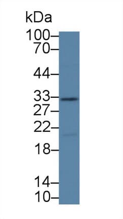 KLK14 / Kallikrein 14 Antibody (aa36-267, HRP)