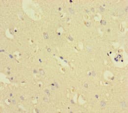 Polyclonal Rabbit anti-Human TXNDC8 Antibody