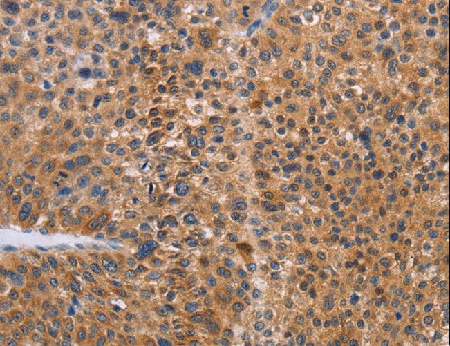 Polyclonal Rabbit anti-Human ALS2CR1 / NIF3L1 Antibody (IHC)