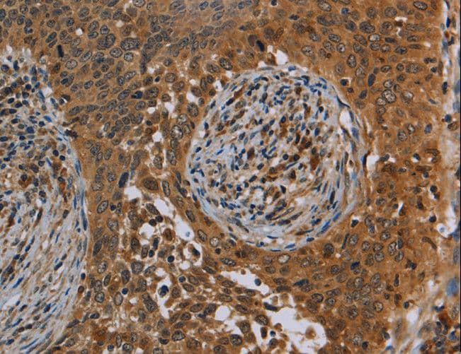 OSM / Oncostatin M Antibody