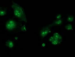CDCP1 Antibody (clone OTI2G2)
