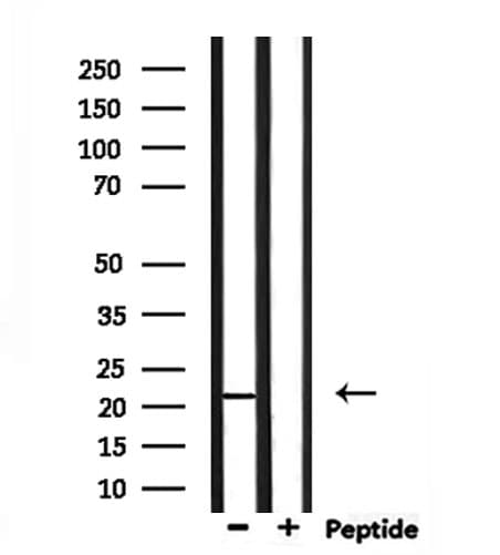 TMEM37 Antibody