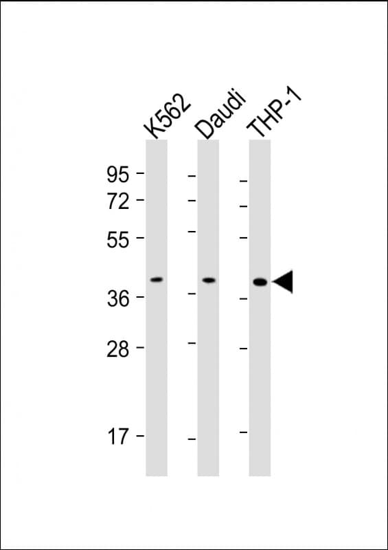 SPI1 / PU.1 Antibody (clone 1835CT291.10.52)