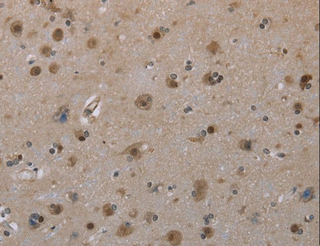 MGLL / Monoacylglycerol Lipase Antibody